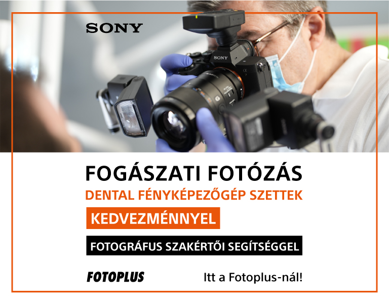 Fogászati Fotózáshoz Megoldások - Fotográfus Szakértői Támogatással - Dental fényképezőgép szettek!