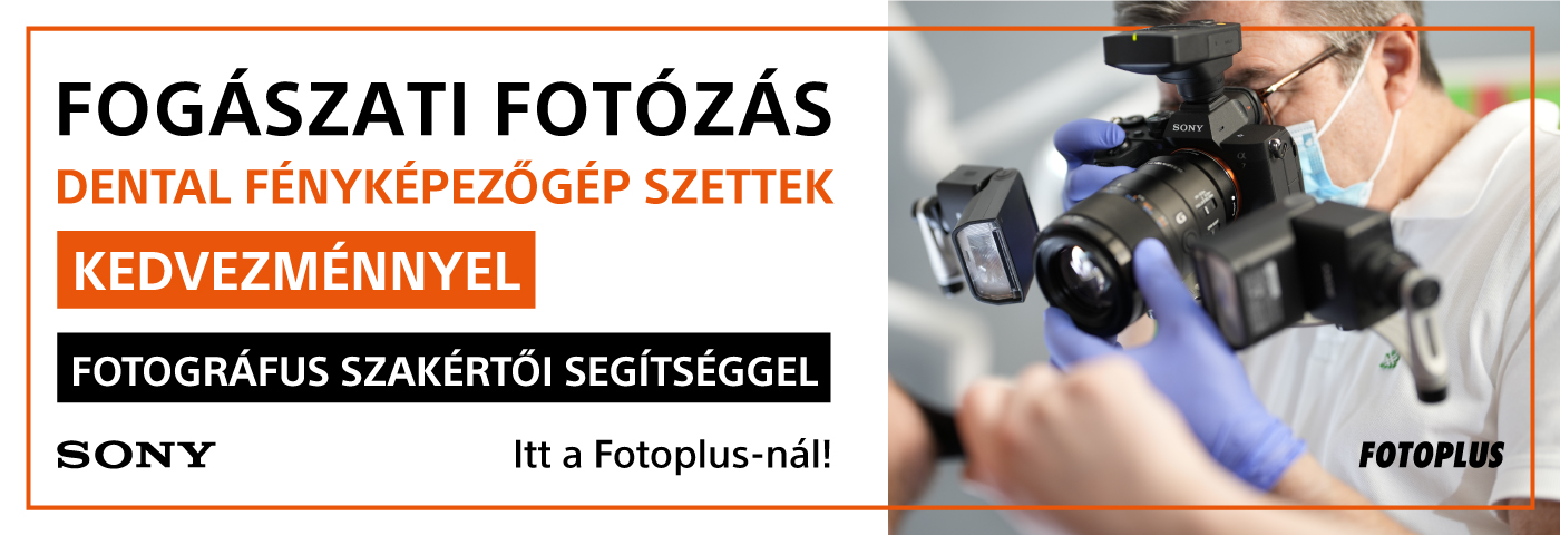 	Fogászati Fotózáshoz Megoldások - Fotográfus Szakértői Támogatással - Dental fényképezőgép szettek!